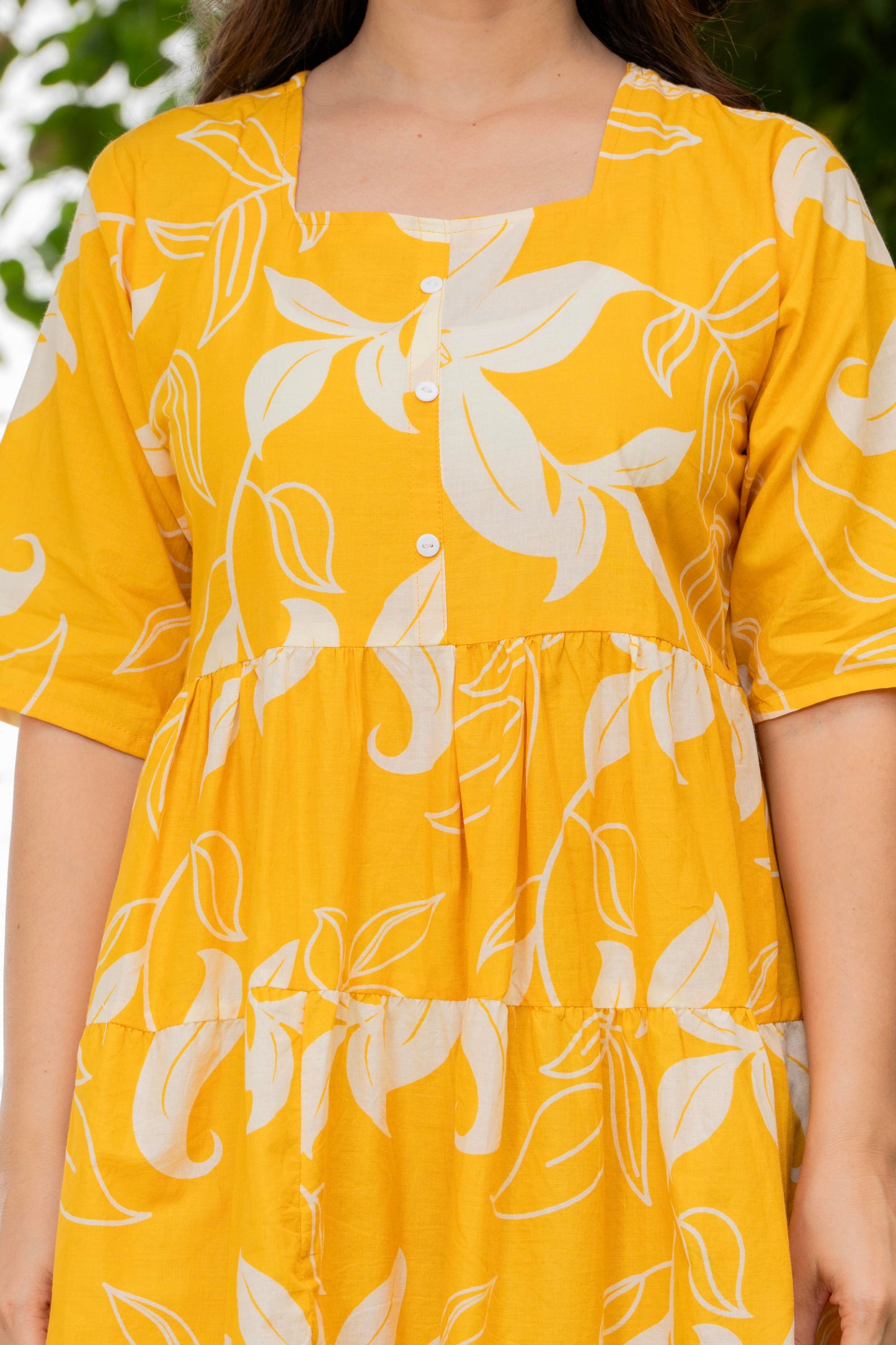 Yellow Printed Cotton Tunic Dress